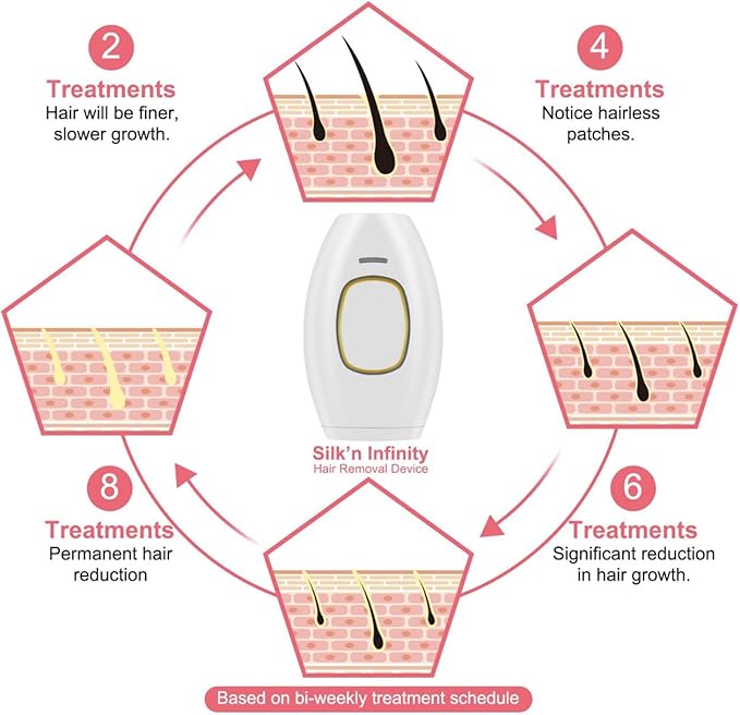 Home IPL Hair Removal Device - Professional Permanent Hair Reduction with 500,000 Flashes, Wireless & Lightweight