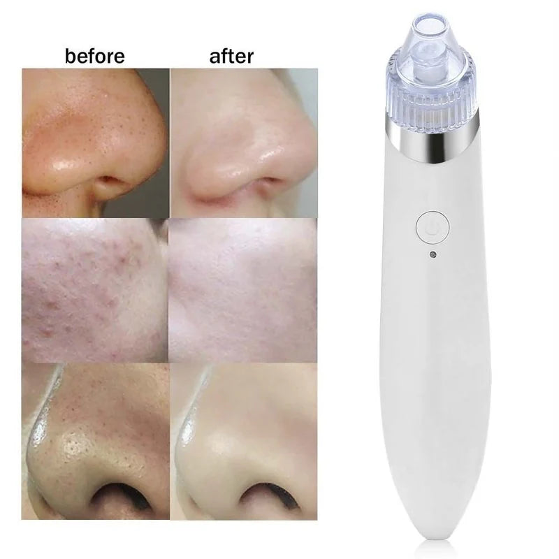 Electric Blackhead Remover Vacuum Suction Machine Rose Gold/Silver